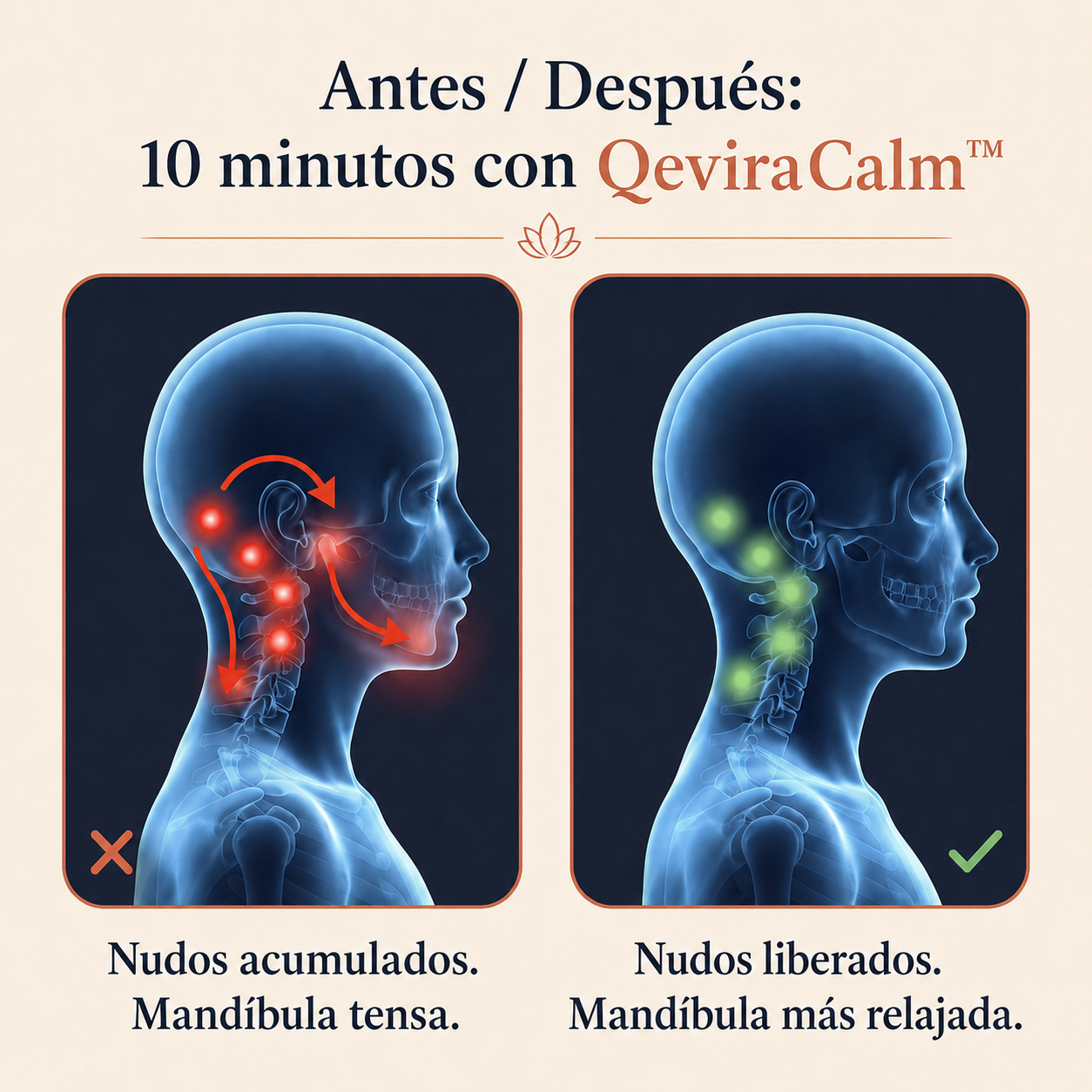 QeviraCalm™Dale un descanso a tu mandíbula